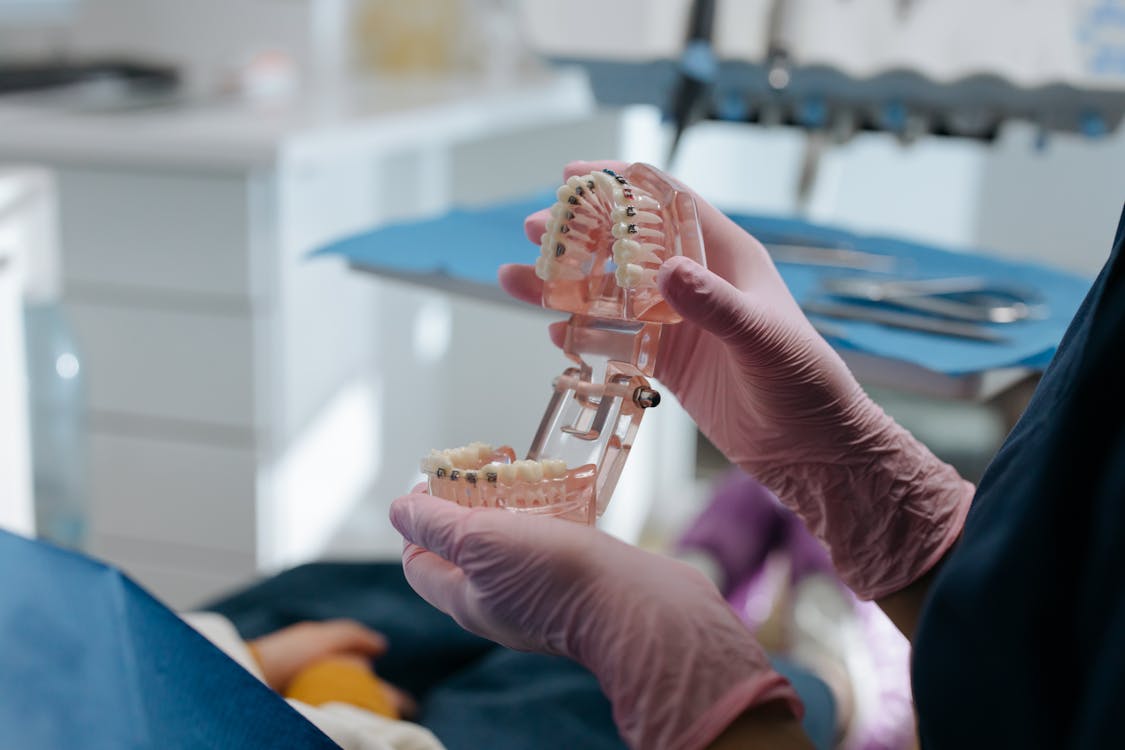 Dental Fillings in Townsville