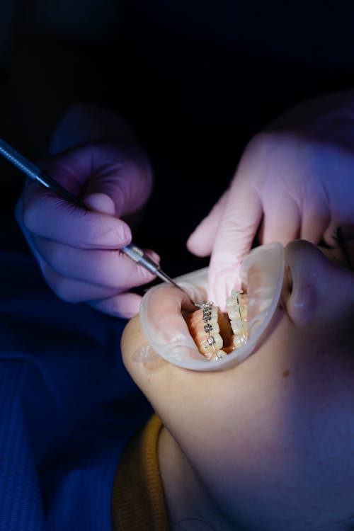 Gum Disease Treatment in Townsville