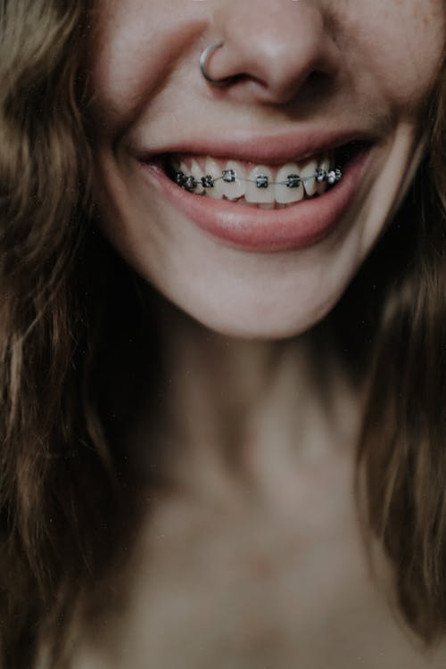 Orthodontics in Townsville