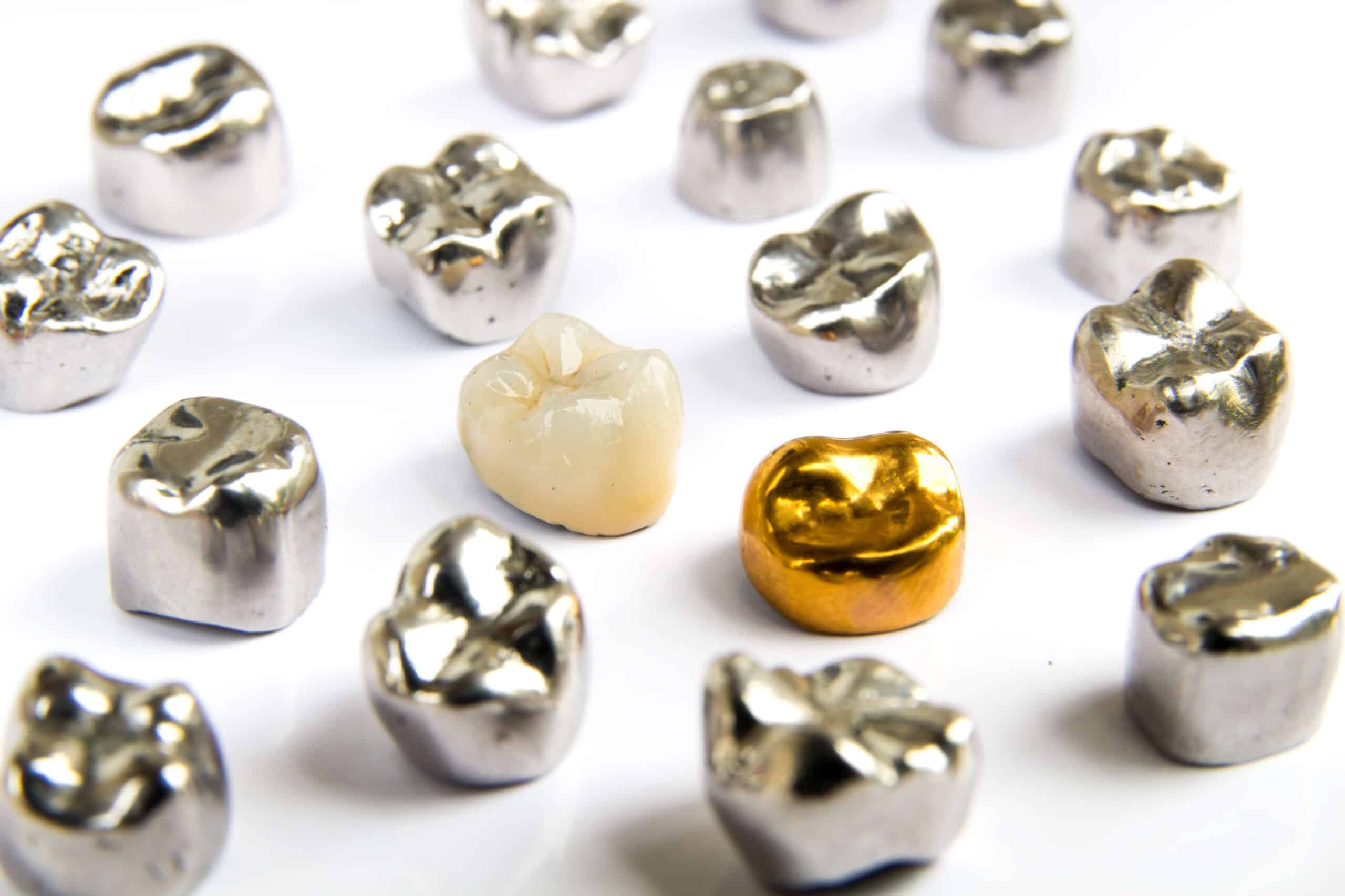 Metal Dental Crowns