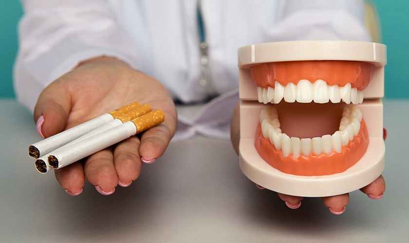 dental implant and smoking